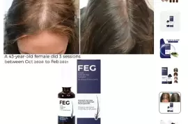 Hair Growth Spray / Free Shipping 
